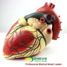 HEART09 (12485) Modelo anatómico de corazón humano de gran tamaño, 3 piezas, Modelos de anatomía&gt; Modelos de corazón